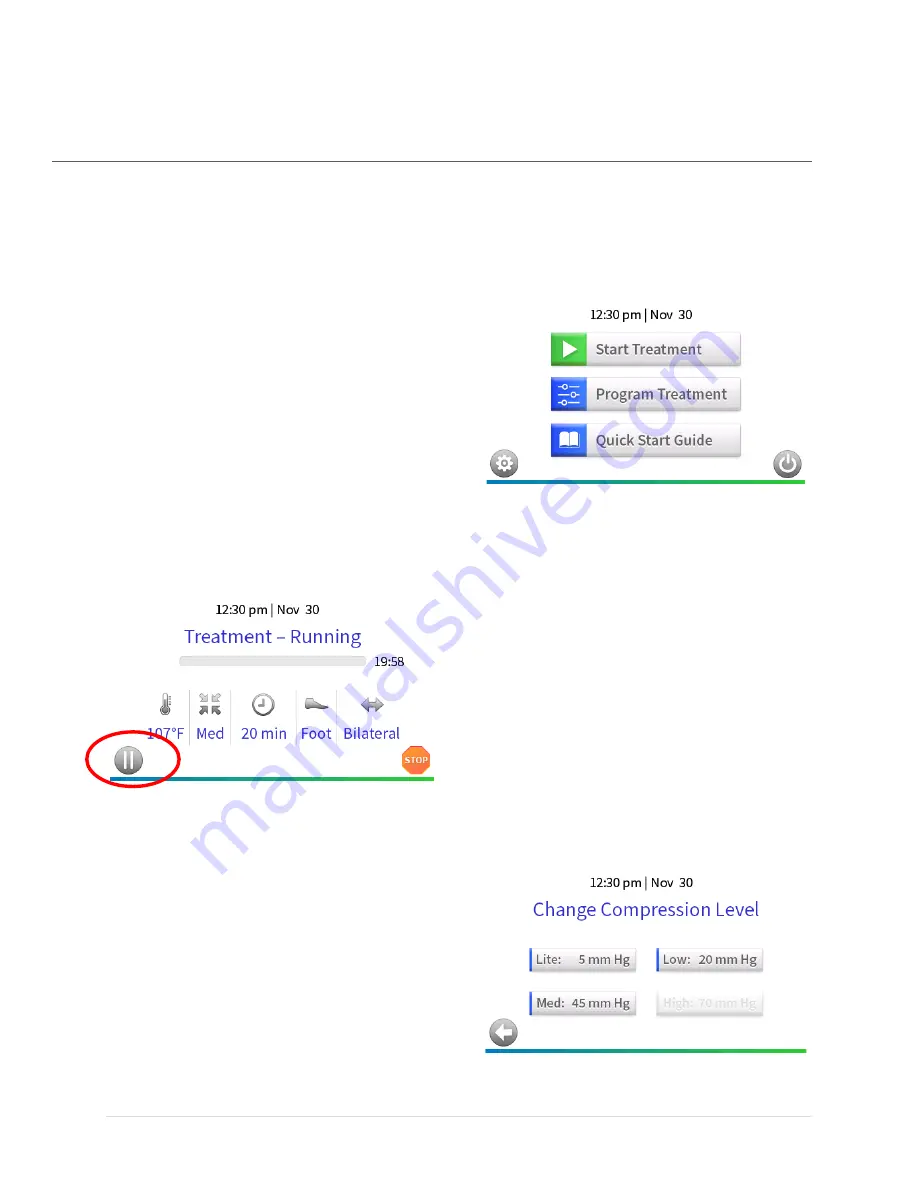 Zenith Therm-X AT User Manual Download Page 10