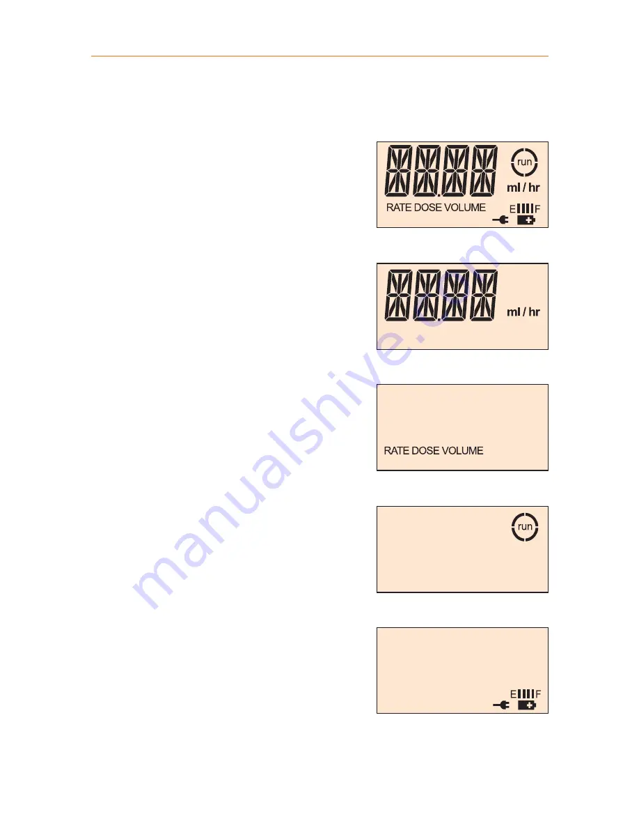 Zevex Infinity Orange Operator'S Manual Download Page 11