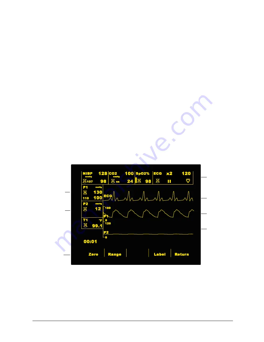 ZOLL Invasive Blood Pressure Manual Download Page 12