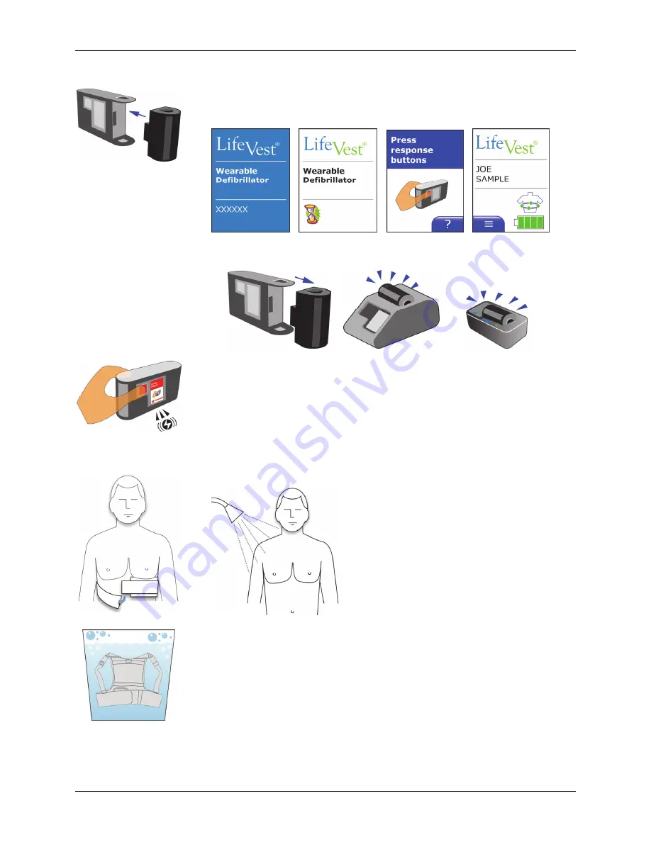 ZOLL LifeVest 4000 Patient Manual Download Page 26